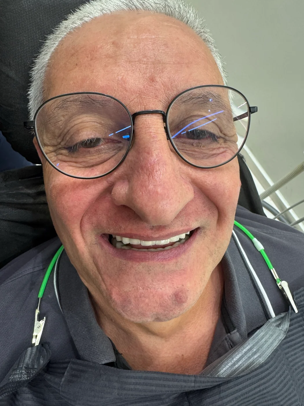 Crown replacement, back molar