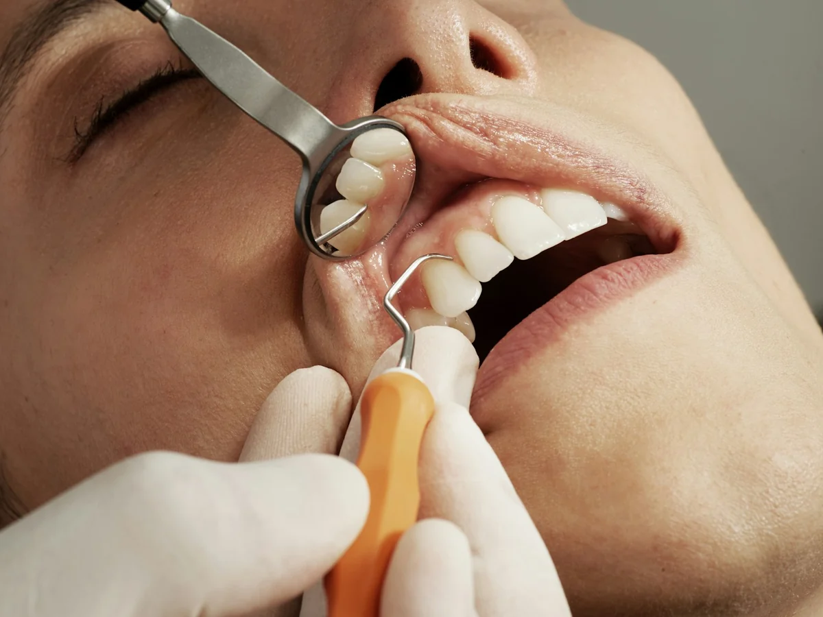 A close view of a dental examination
